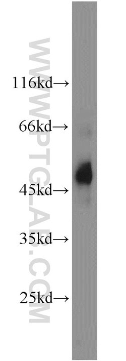 Renin receptor/ATP6AP2 Rabbit anti-Human, Mouse, Rat, Polyclonal, Proteintech:Antibodies:Primary