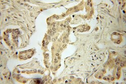 AMPK alpha 1 Rabbit anti-Human, Mouse, Rat, Polyclonal, Proteintech 150