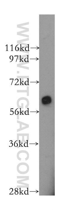 AMPK alpha 1 Rabbit anti-Human, Mouse, Rat, Polyclonal, Proteintech 150