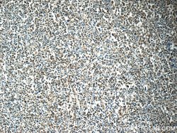 MEF2BNB Rabbit anti-Human, Mouse, Polyclonal, Proteintech 150 &mu;L | Buy Online | Proteintech Group Inc | Fisher Scientific