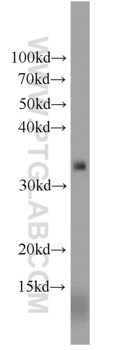 NKG2A Rabbit anti-Human, Polyclonal, Proteintech 150 &mu;L; Unconjugated:Antibodies,