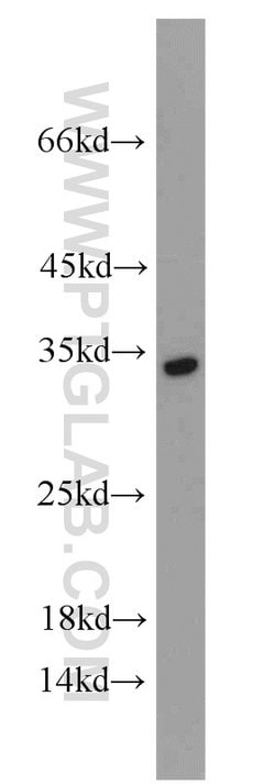NKG2A Rabbit anti-Human, Polyclonal, Proteintech 150 &mu;L; Unconjugated:Antibodies,