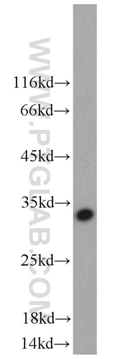 NKG2A Rabbit anti-Human, Polyclonal, Proteintech 150 &mu;L; Unconjugated:Antibodies,