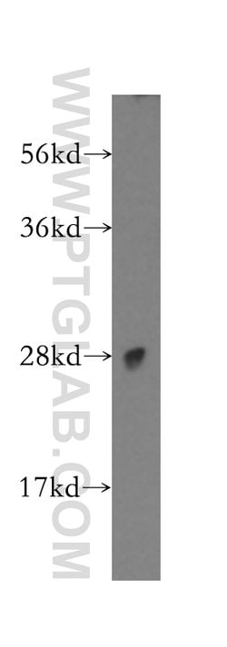 NKG2A Rabbit anti-Human, Polyclonal, Proteintech 150 &mu;L; Unconjugated:Antibodies,