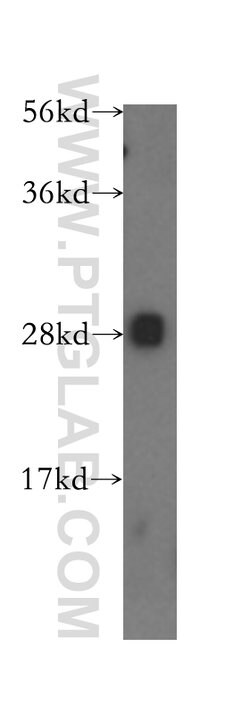 NKG2A Rabbit anti-Human, Polyclonal, Proteintech 150 &mu;L; Unconjugated:Antibodies,