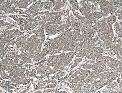 TPK1 Rabbit anti-Human, Mouse, Rat, Polyclonal, Proteintech 150 &mu;L;