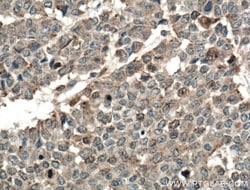 TPK1 Rabbit anti-Human, Mouse, Rat, Polyclonal, Proteintech 150 &mu;L;