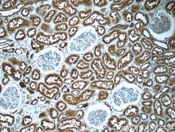 TPK1 Rabbit anti-Human, Mouse, Rat, Polyclonal, Proteintech 150 &mu;L;