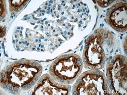 TPK1 Rabbit anti-Human, Mouse, Rat, Polyclonal, Proteintech 150 &mu;L;