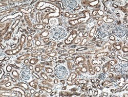 TPK1 Rabbit anti-Human, Mouse, Rat, Polyclonal, Proteintech 150 &mu;L;