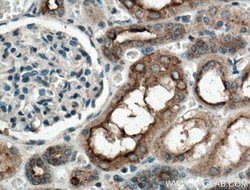 TPK1 Rabbit anti-Human, Mouse, Rat, Polyclonal, Proteintech 150 &mu;L;