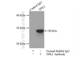 TPK1 Rabbit anti-Human, Mouse, Rat, Polyclonal, Proteintech 150 &mu;L;