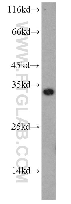 TPK1 Rabbit anti-Human, Mouse, Rat, Polyclonal, Proteintech 150 &mu;L;