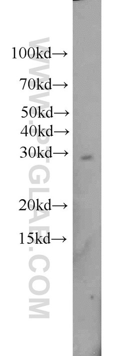 TPK1 Rabbit anti-Human, Mouse, Rat, Polyclonal, Proteintech 150 &mu;L;