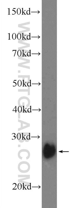 TPK1 Rabbit anti-Human, Mouse, Rat, Polyclonal, Proteintech 150 &mu;L;