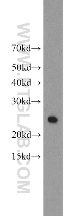 TPK1 Rabbit anti-Human, Mouse, Rat, Polyclonal, Proteintech 150 &mu;L;