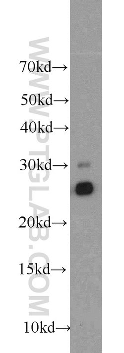 TPK1 Rabbit anti-Human, Mouse, Rat, Polyclonal, Proteintech 150 &mu;L;
