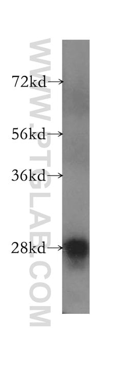 TPK1 Rabbit anti-Human, Mouse, Rat, Polyclonal, Proteintech 150 &mu;L;