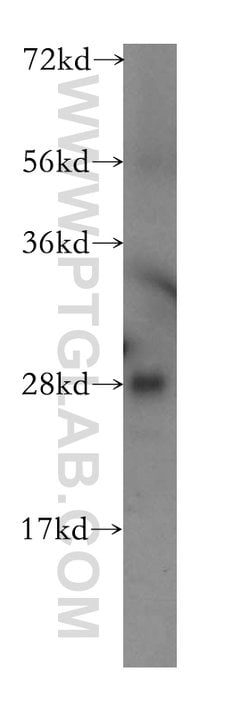 TPK1 Rabbit anti-Human, Mouse, Rat, Polyclonal, Proteintech 150 &mu;L;