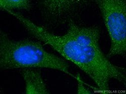 Cofilin Rabbit anti-Human, Mouse, Rat, Polyclonal, Proteintech:Antibodies:Primary