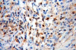 Cofilin Rabbit anti-Human, Mouse, Rat, Polyclonal, Proteintech:Antibodies:Primary