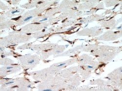 Cofilin Rabbit anti-Human, Mouse, Rat, Polyclonal, Proteintech:Antibodies:Primary