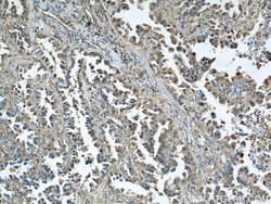 Cofilin Rabbit anti-Human, Mouse, Rat, Polyclonal, Proteintech:Antibodies:Primary