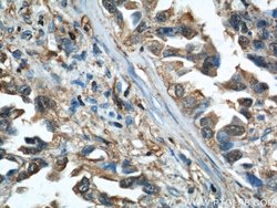 Cofilin Rabbit anti-Human, Mouse, Rat, Polyclonal, Proteintech:Antibodies:Primary