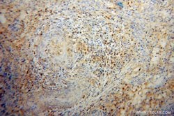 Cofilin Rabbit anti-Human, Mouse, Rat, Polyclonal, Proteintech:Antibodies:Primary