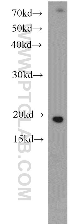 Cofilin Rabbit anti-Human, Mouse, Rat, Polyclonal, Proteintech:Antibodies:Primary
