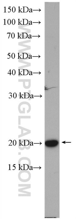 Cofilin Rabbit anti-Human, Mouse, Rat, Polyclonal, Proteintech:Antibodies:Primary