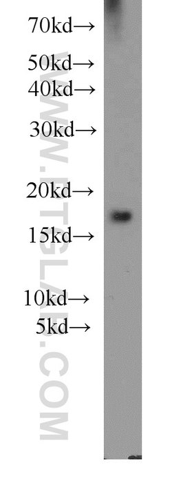 Cofilin Rabbit anti-Human, Mouse, Rat, Polyclonal, Proteintech:Antibodies:Primary
