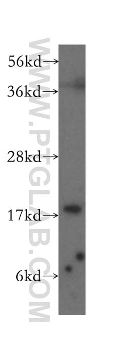 Cofilin Rabbit anti-Human, Mouse, Rat, Polyclonal, Proteintech:Antibodies:Primary