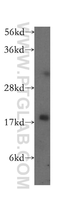 Cofilin Rabbit anti-Human, Mouse, Rat, Polyclonal, Proteintech:Antibodies:Primary