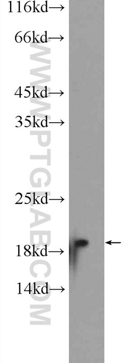 Cofilin Rabbit anti-Human, Mouse, Rat, Polyclonal, Proteintech:Antibodies:Primary