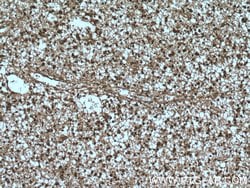 DCUN1D1 Rabbit anti-Human, Mouse, Rat, Polyclonal, Proteintech 150 &mu;L;