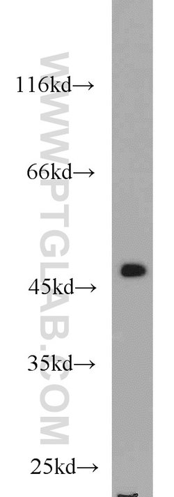 FH Rabbit anti-Human, Mouse, Rat, Polyclonal, Proteintech 20 &mu;L | Buy Online | Proteintech | Fisher Scientific