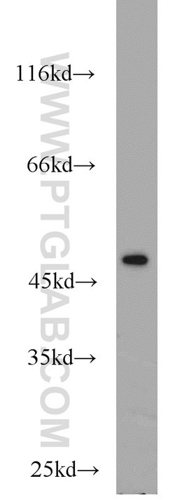 FH Rabbit anti-Human, Mouse, Rat, Polyclonal, Proteintech 20 &mu;L | Buy Online | Proteintech | Fisher Scientific