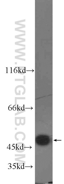 FH Rabbit anti-Human, Mouse, Rat, Polyclonal, Proteintech 20 &mu;L | Buy Online | Proteintech | Fisher Scientific