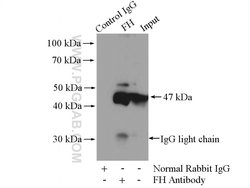 FH Rabbit anti-Human, Mouse, Rat, Polyclonal, Proteintech 20 &mu;L | Buy Online | Proteintech | Fisher Scientific