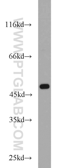 FH Rabbit anti-Human, Mouse, Rat, Polyclonal, Proteintech 20 &mu;L | Buy Online | Proteintech | Fisher Scientific
