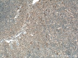 KLRG1 Rabbit anti-Human, Polyclonal, Proteintech 20 &mu;L; Unconjugated:Anticorps,