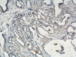 KLRG1 Rabbit anti-Human, Polyclonal, Proteintech 20 &mu;L; Unconjugated:Anticorps,