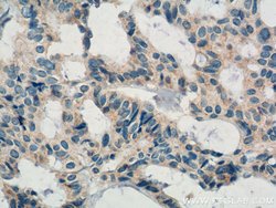 KLRG1 Rabbit anti-Human, Polyclonal, Proteintech 20 &mu;L; Unconjugated:Anticorps,