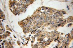 KLRG1 Rabbit anti-Human, Polyclonal, Proteintech 20 &mu;L; Unconjugated:Anticorps,