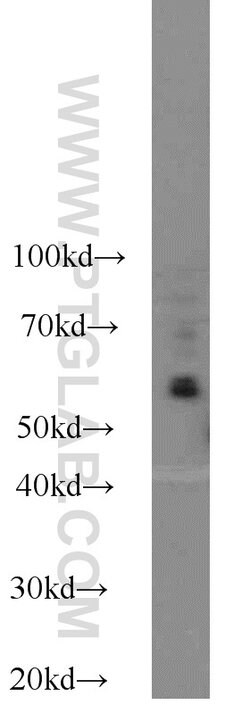 KLRG1 Rabbit anti-Human, Polyclonal, Proteintech 20 &mu;L; Unconjugated:Anticorps,