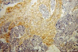 HSD17B2 Rabbit anti-Human, Polyclonal, Proteintech:Antibodies:Primary Antibodies
