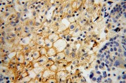 HSD17B2 Rabbit anti-Human, Polyclonal, Proteintech:Antibodies:Primary Antibodies