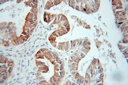 HSD17B2 Rabbit anti-Human, Polyclonal, Proteintech:Antibodies:Primary Antibodies