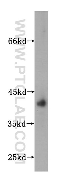 HSD17B2 Rabbit anti-Human, Polyclonal, Proteintech:Antibodies:Primary Antibodies